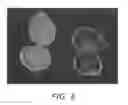 Fig. 06 - Polysaccharide gel formulation having multi-stage bioactive agent delivery