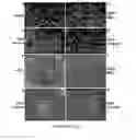 Fig. 06 - CELL THERAPY FOR TREATMENT OF LIVER FAILURE