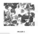 Fig. 03 - Enzyme Delivery Systems and Methods of Preparation and Use