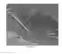 Fig. 10 - NOVEL INJECTABLE CHITOSAN MIXTURES FORMING HYDROGELS