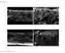 Fig. 02 - Production Method For Cryopreserved Acellular Dermal Matrix, And Cryopreserved Acellular Dermal Matrix Produced Thereby