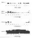 Fig. 11 - Method of using beta-hydroxy-beta-methylbutyrate and fatty acids for treating disease-associated wasting