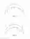 Fig. 02 - Grass Yarn