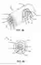 Fig. 05 - ELECTROSPUN MICROTUBES AND NANOTUBES CONTAINING RHEOLOGICAL FLUID