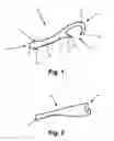 Fig. 02 - ORTHODONTIC ALIGNER REMOVAL TOOL