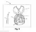 Fig. 06 - ORTHODONTIC ALIGNER REMOVAL TOOL
