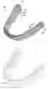 Fig. 01 - Dental positioning appliance having metallic portion