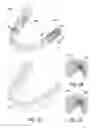 Fig. 03 - Dental positioning appliance having metallic portion