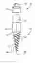 Fig. 01 - Aesthetically Enhanced Temporary Anchorage Device and Method of Use Thereof