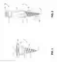 Fig. 02 - Aesthetically Enhanced Temporary Anchorage Device and Method of Use Thereof