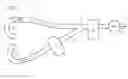 Fig. 08 - Catch Device for Catching Particles in Oral Fluid Originating in the Mouth of a Patient in Dental Treatments