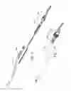 Fig. 03 - ULTRASONIC DENTAL INSERT AND LIGHTED HANDPIECE ASSEMBLY