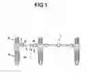 Fig. 02 - 3-PLANS ARTICULATED BAR TO USE IN DENTAL IMPLANTS