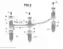 Fig. 03 - 3-PLANS ARTICULATED BAR TO USE IN DENTAL IMPLANTS