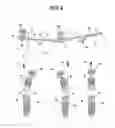 Fig. 05 - 3-PLANS ARTICULATED BAR TO USE IN DENTAL IMPLANTS