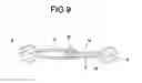 Fig. 10 - 3-PLANS ARTICULATED BAR TO USE IN DENTAL IMPLANTS