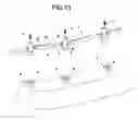 Fig. 14 - 3-PLANS ARTICULATED BAR TO USE IN DENTAL IMPLANTS