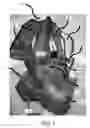 Fig. 04 - Flexible and rigid endoscopic training device (FRED)