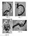Fig. 05 - Flexible and rigid endoscopic training device (FRED)
