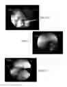 Fig. 06 - Flexible and rigid endoscopic training device (FRED)