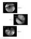 Fig. 07 - Flexible and rigid endoscopic training device (FRED)