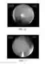 Fig. 08 - Flexible and rigid endoscopic training device (FRED)