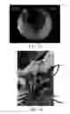 Fig. 09 - Flexible and rigid endoscopic training device (FRED)
