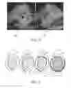 Fig. 04 - Tumor ablation training system