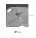 Fig. 05 - Tumor ablation training system