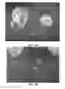 Fig. 03 - METHODS AND COMPOSITIONS FOR THE CRYOPRESERVATION OF DUCKWEED