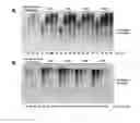 Fig. 07 - Phage phi29 DNA polymerase chimera