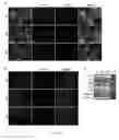 Fig. 02 - METHODS FOR OBTAINING HEPATOCYTES, HEPATIC ENDODERM CELLS AND HEPATIC PROGENITOR CELLS BY INDUCED DIFFERENTIATION