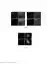Fig. 16 - METHODS FOR OBTAINING HEPATOCYTES, HEPATIC ENDODERM CELLS AND HEPATIC PROGENITOR CELLS BY INDUCED DIFFERENTIATION