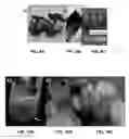 Fig. 06 - Three-dimensional bioprinting of biosynthetic cellulose (BC) implants and scaffolds for tissue engineering