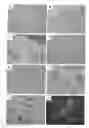 Fig. 01 - Human neuronal progenitor cells co-expressing nestin and Pax6, and co-expressing NeuN or Tuj1