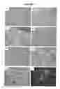 Fig. 02 - Human neuronal progenitor cells co-expressing nestin and Pax6, and co-expressing NeuN or Tuj1