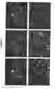 Fig. 04 - Human neuronal progenitor cells co-expressing nestin and Pax6, and co-expressing NeuN or Tuj1