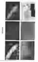 Fig. 05 - Human neuronal progenitor cells co-expressing nestin and Pax6, and co-expressing NeuN or Tuj1