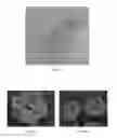 Fig. 03 - Macroporous Microcarrier Specific to Liver Cell, Preparation Method and Use Thereof