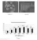 Fig. 07 - Macroporous Microcarrier Specific to Liver Cell, Preparation Method and Use Thereof