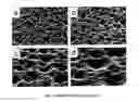 Fig. 04 - Method for producing and structuring a zinc oxide layer and zinc oxide layer