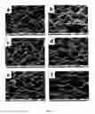 Fig. 07 - Method for producing and structuring a zinc oxide layer and zinc oxide layer