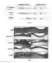 Fig. 02 - Method for treatment of inflammatory disease and disorder