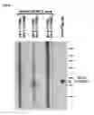 Fig. 07 - GENES AND POLYPEPTIDES RELATING TO HUMAN COLON CANCERS