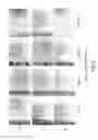 Fig. 03 - ANGIOGENESIS INHIBITORS