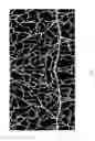 Fig. 02 - Methods of inhibiting choroidal neovascularization