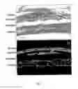 Fig. 03 - Methods of inhibiting choroidal neovascularization