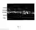 Fig. 04 - Methods of inhibiting choroidal neovascularization