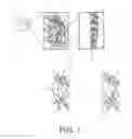 Fig. 02 - METHOD FOR THE PRODUCTION OF SCAFFOLDS FOR TISSUE ENGINEERING, COMPRISING THE USEOF AN ANCHORING UNIT, AND SCAFFOLD PRODUCED THEREWITH