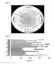 Fig. 02 - Stabilization of Chloropropenes
